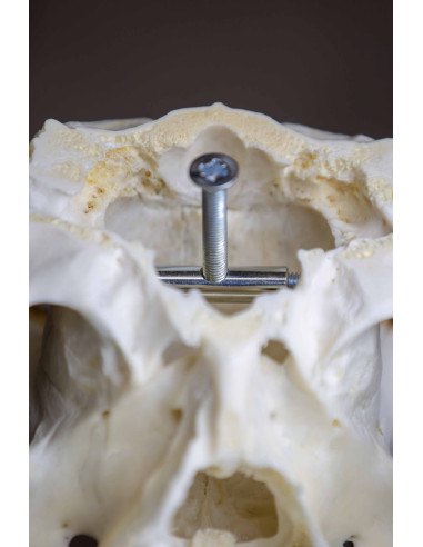 Trofeskruv Kronhjort